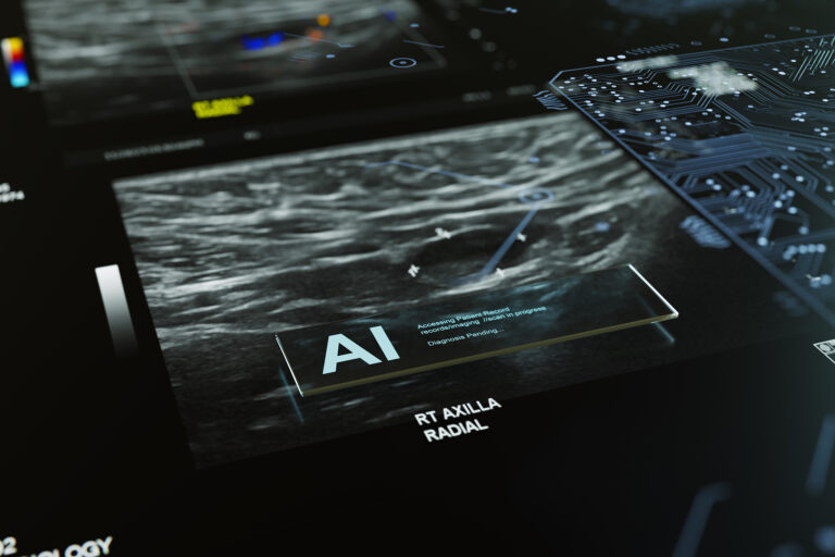 Premier essai mondial : l’IA aide les médecins à détecter le cancer du sein grâce aux scanners